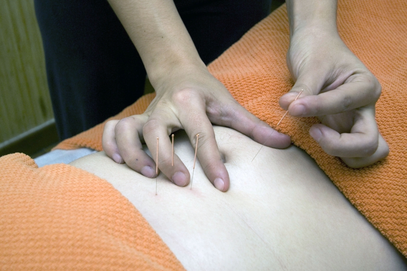 osteopathe-GILETTE-min_acupuncture-4175625